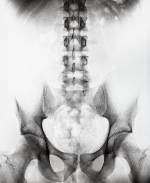 男性脊柱和骨盆x光片图片下载