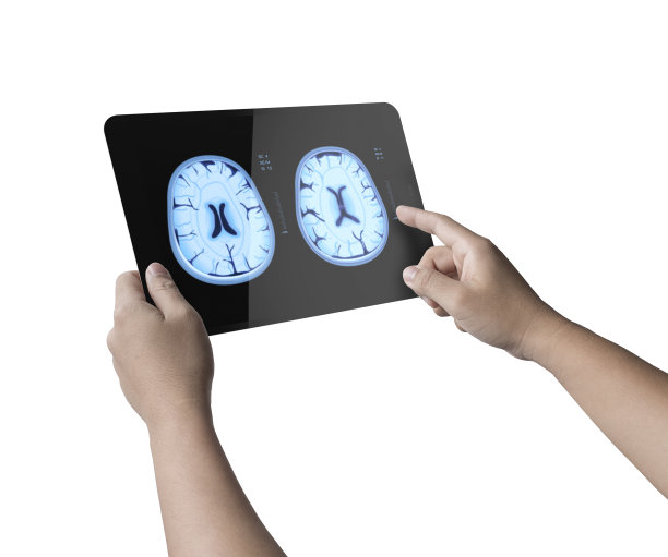 平板显示x光大脑图片下载