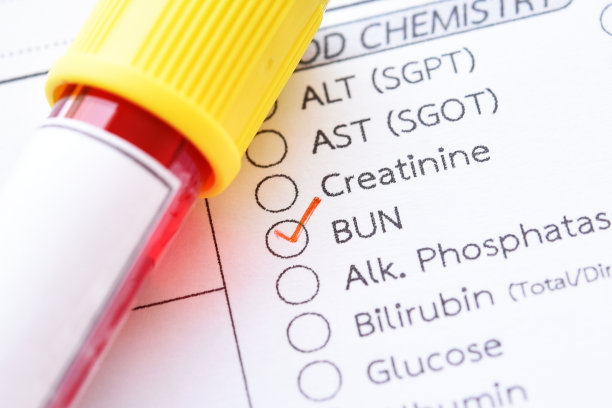 血液采样管，用于尿素氮(Blood尿素氮)检测图片下载