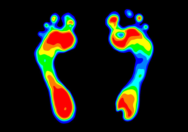 脚压图，脚压分析图片下载