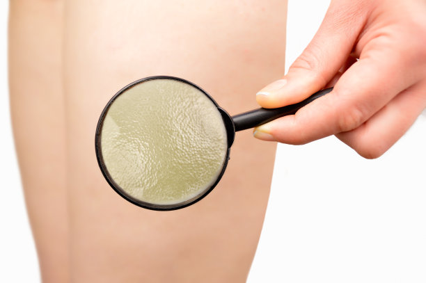 橙色的皮肤图片下载