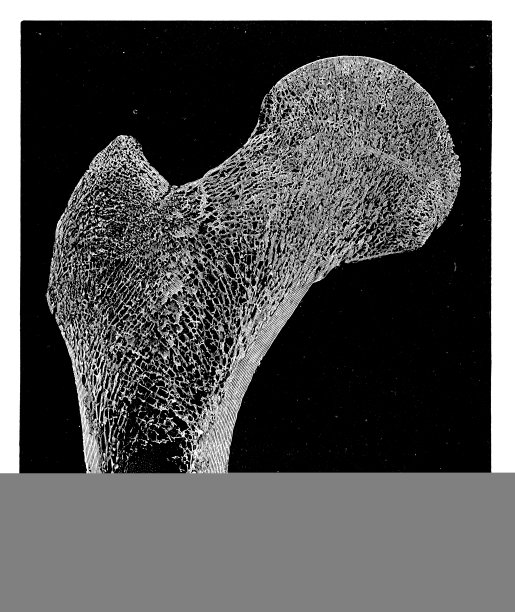 大腿骨头部的松质结构图片下载