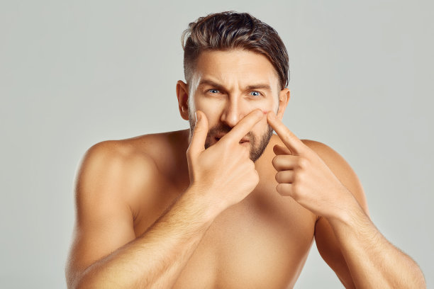 年轻人捏住她脸上的痘痘，把痘痘从脸上去掉图片下载