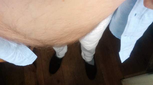 脂肪瘤的身体图片下载