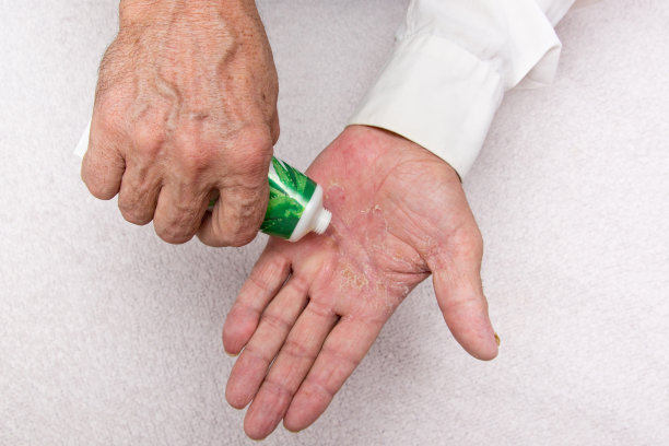 老人手上的药膏。使用软膏和润肤乳霜来治疗和滋润皮肤。老年皮肤问题图片下载