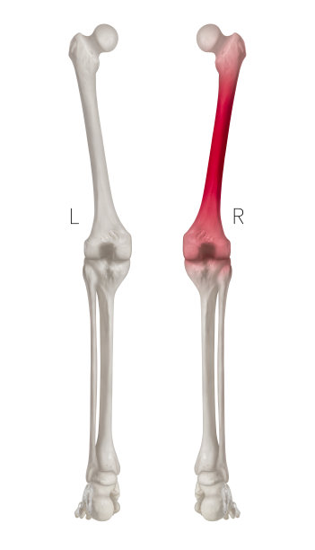 人体左腿骨和右腿骨-股骨疼痛区域的红色突出部分后视图- 3D医学-生物医学插图-人体解剖和医学概念-在白色背景上分离。图片下载