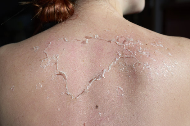 多晒黑图片下载