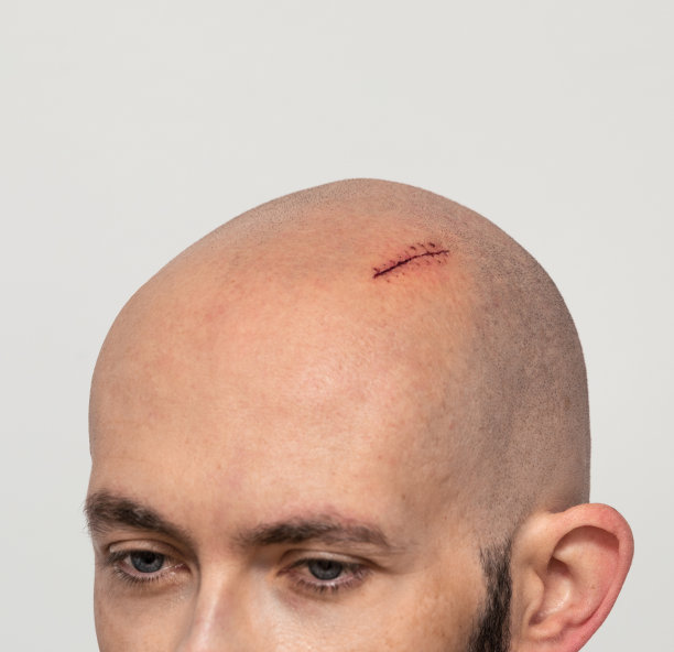 头部受伤图片下载