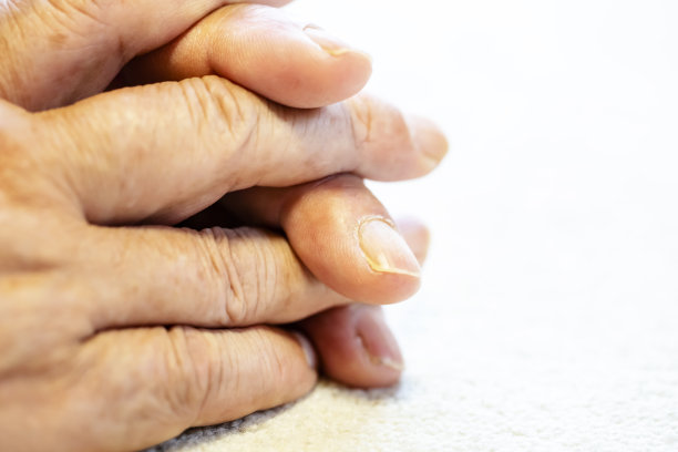 年长者或老人的照片，皱纹的手。图片下载