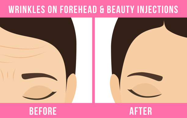 整容手术肉毒杆菌图片下载