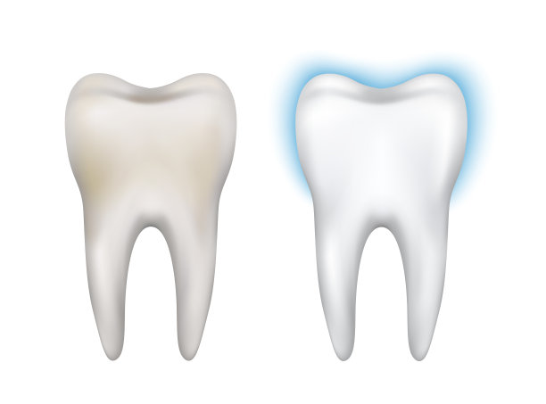 矢量现实脏和干净的牙齿模型-美白，牙齿卫生，健康图片下载