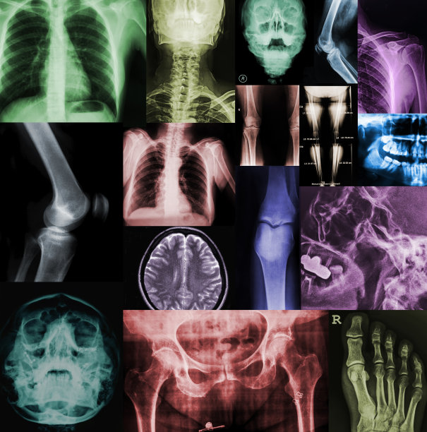 色彩斑斓的x射线图片下载