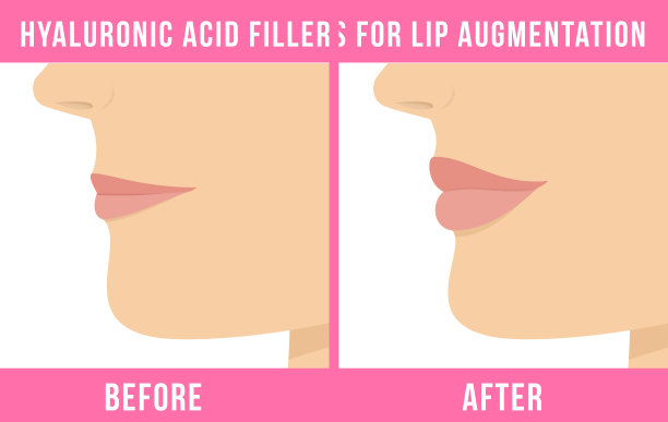 唇术效果图片下载