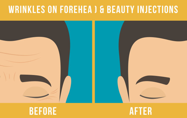 整容手术肉毒杆菌图片下载