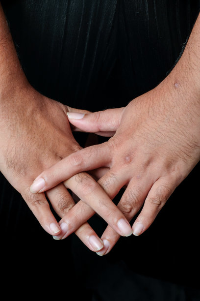 细节特写性皮炎图片下载