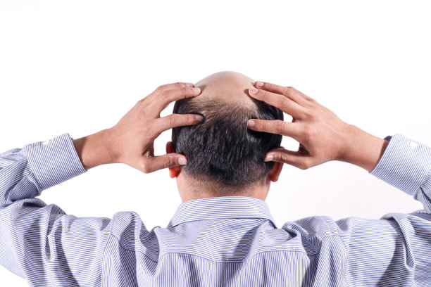 光头商人与他的头在头皮上从后面看与白色背景图片下载