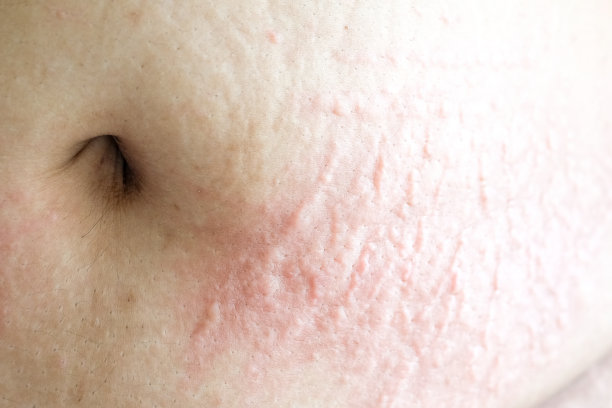 宏皮肤损伤图片下载