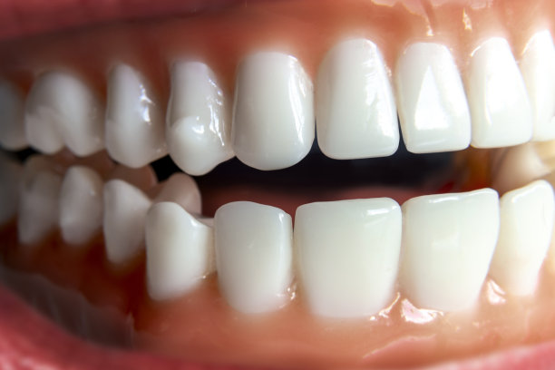 健康义齿模牙。图片下载