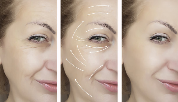 女人脸上皱纹前后程序，箭头图片下载