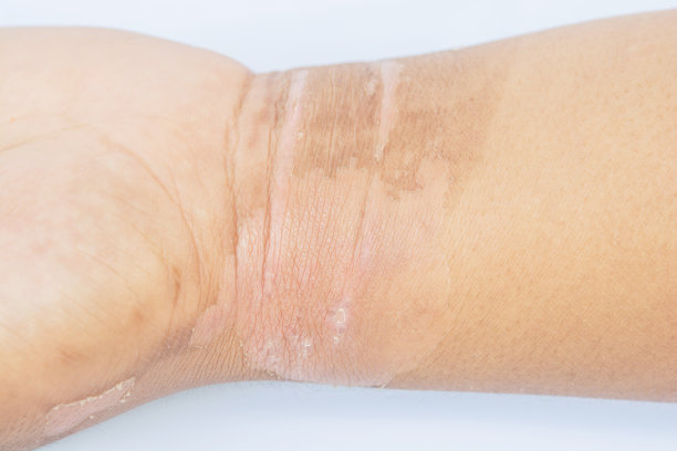 手泡热水图片下载