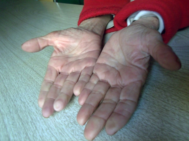 一个老太太的手图片下载