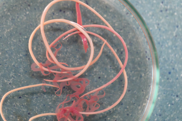 蛔虫病是由寄生蛔虫引起的一种疾病，用于实验室的教育。图片下载