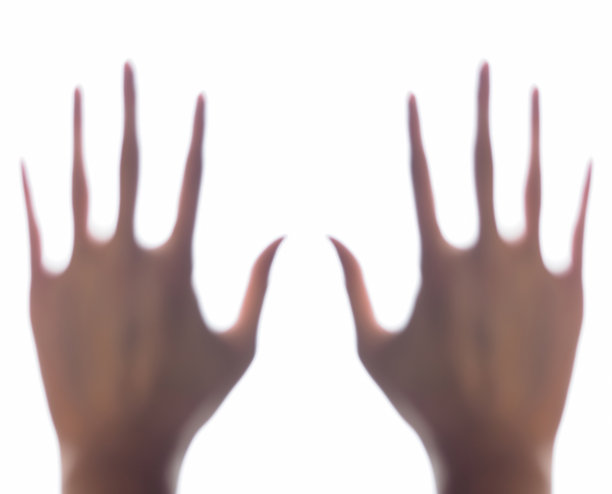 外星人解剖手观图片下载