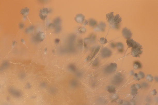 霉菌美丽，菌落特性的培养培养基板从实验室微生物。图片下载