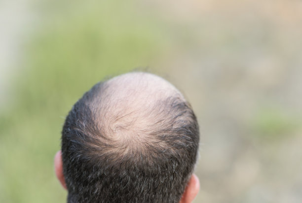 即将成为户外肖像图片下载