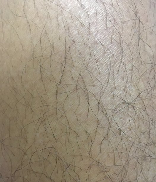 皮肤表面图片下载