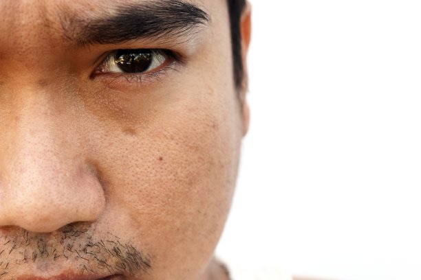 亚洲男人面部皮肤长时间不睡觉和不照顾图片下载