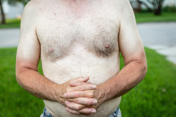 赤裸上身，手臂晒伤的白人男性图片下载