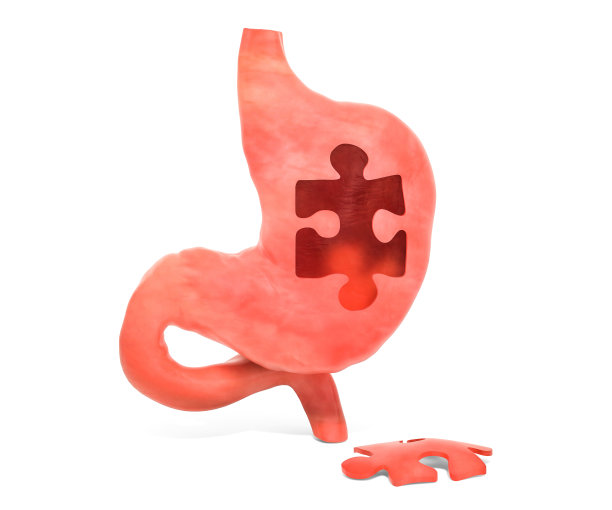 胃病或感染概念，3D渲染图片下载
