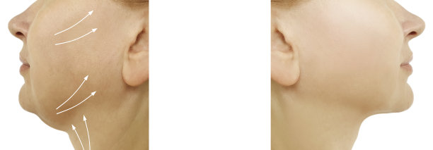 女士双下巴前后程序，椭圆润饰女士双下巴前后程序，椭圆润饰图片下载