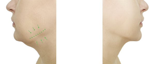 女人下巴前后程序图片下载