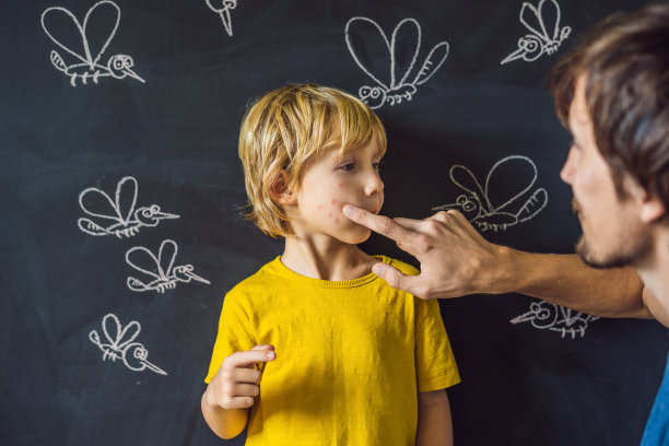 在黑色的背景上，男孩被蚊子咬了一口。爸爸抹了他的咬药膏。在黑板上用粉笔画蚊子图片下载