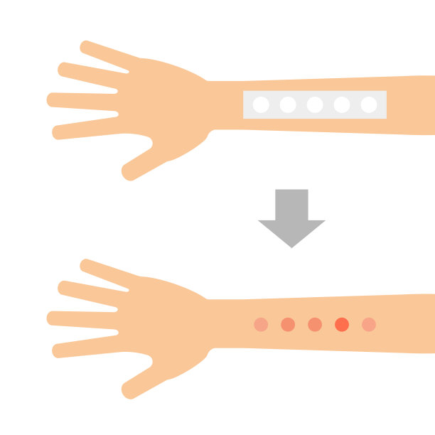 斑贴试验图片下载