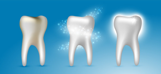 美丽逼真的牙医向量组牙齿清洁过程龋齿，清洁和白色闪亮的牙齿在蓝色的背景。素材图片