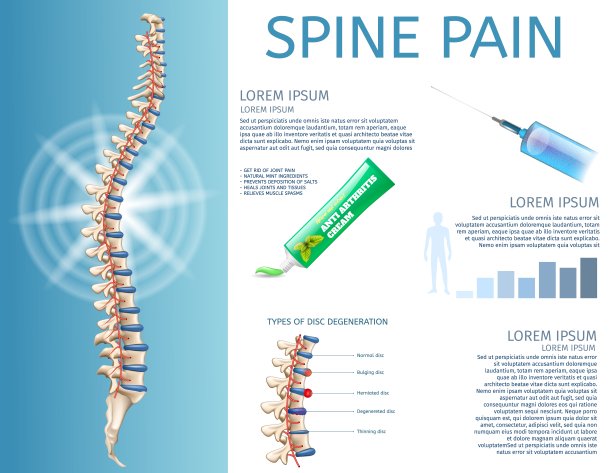 平旗脊柱疼痛的治疗和诊断。图片下载