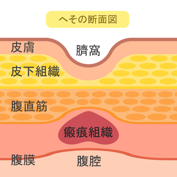 肚脐的结构图片下载