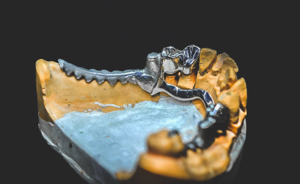 一个人造下颌上的桥的例子图片下载