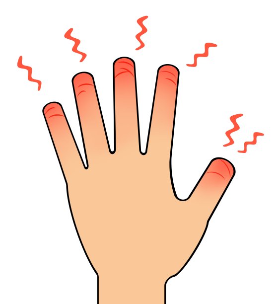 有裂痕的图片下载