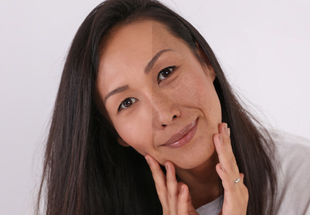 专业女性面部化妆前后对比，用粉底遮盖痘痘疤痕和痤疮图片下载