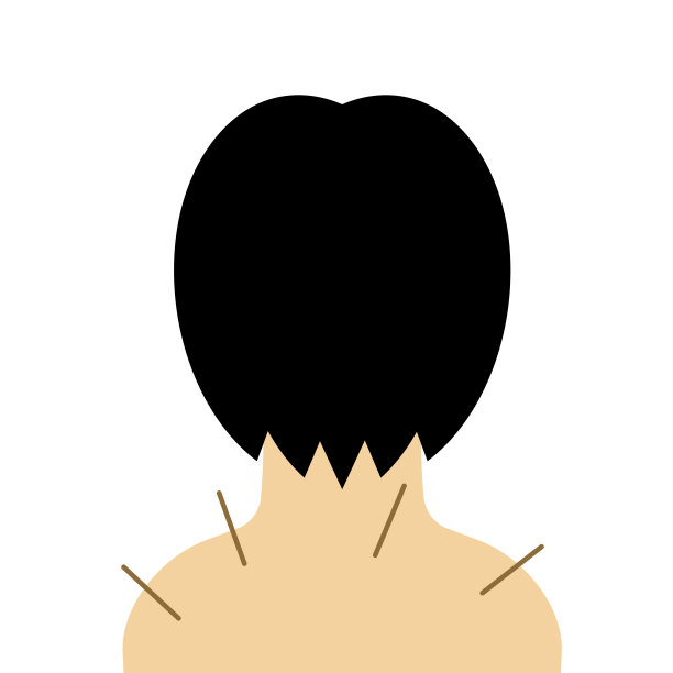 针灸治疗图片下载