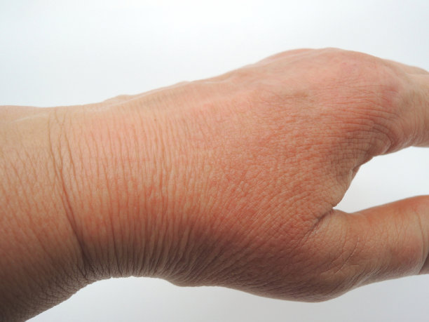 干燥的手。皮肤护理的概念图片下载