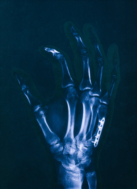 Hnad x射线胶片图片下载