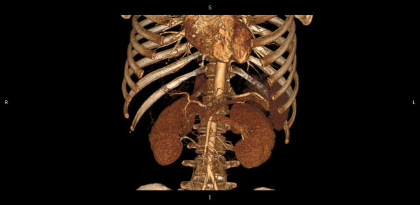 三维身体CT。医学成像。放射学。高分辨率腹部计算机断层摄影图片下载