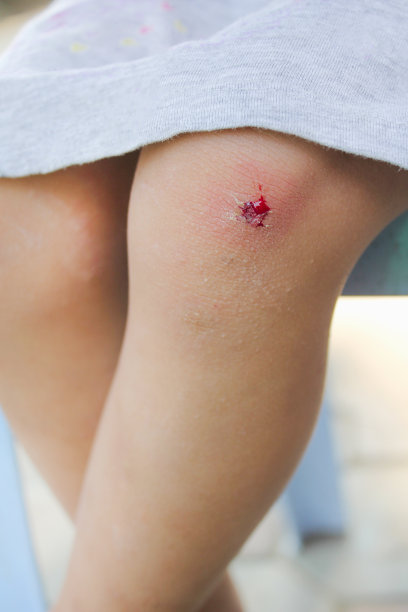 一个亚洲小女孩摔倒在地受伤，膝盖上有血图片下载