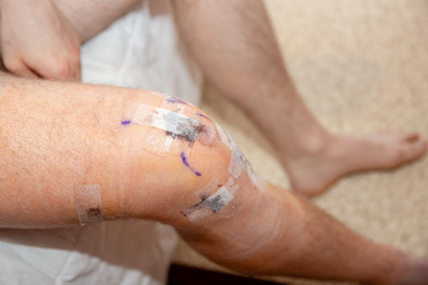 前十字韧带撕裂手术后，男子膝盖脱臼。图片下载