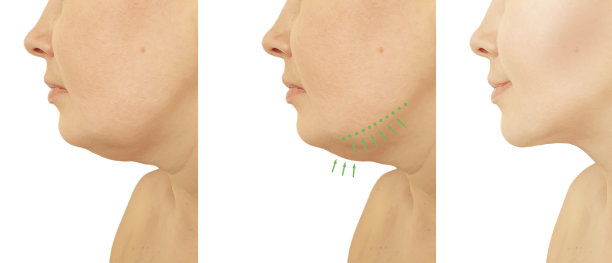 女子双下巴后的程序图片下载